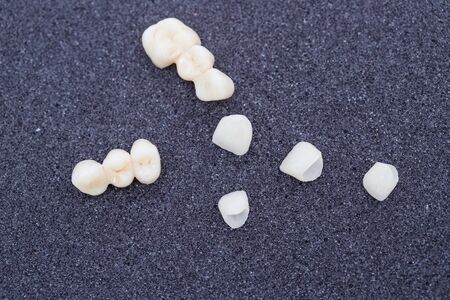 ceramic crowns of human teeth closeup macro isolate on black background.の写真素材