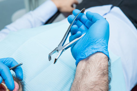 dentist hand in blue gloves with tooth extraction forceps