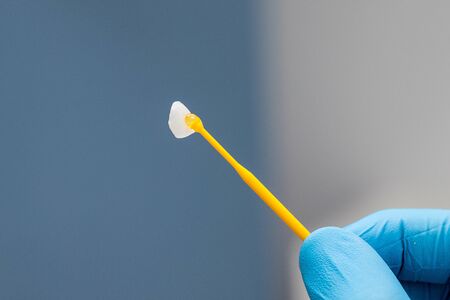 closeup ceramic veneer on a stick in a dentist hand in a blue glove. Orthopedics in Dentistryの写真素材