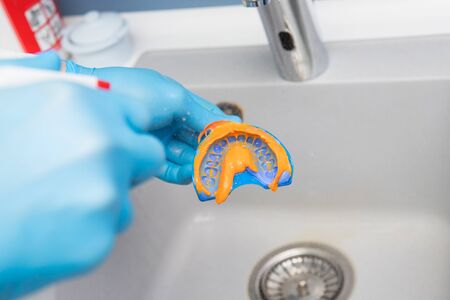 The dentist washes a mold of teeth with water under pressure above the sink. Close-up of dentist's hands in blue glovesの写真素材