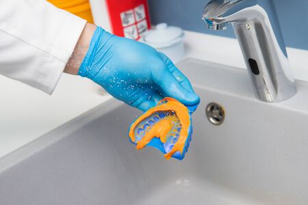 The dentist washes a mold of teeth with water under pressure above the sink. Close-up of dentist's hands in blue glovesの写真素材