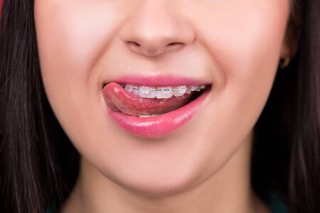 Smiling happy woman mouth with tongue and bracesの写真素材