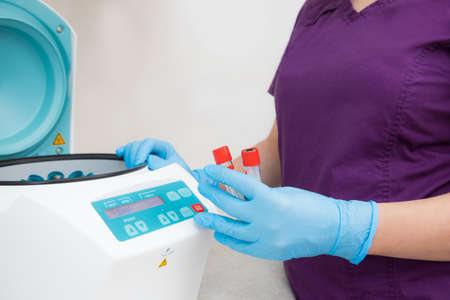 Doctor with test tubes on a plasma therapy centrifuge. Dentistry plasma liftingの写真素材