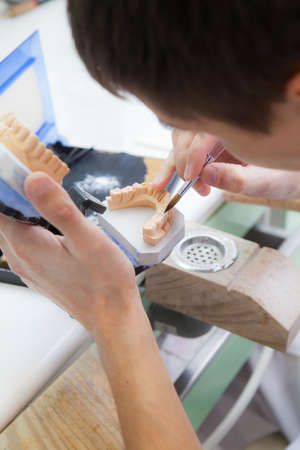 Technician dental is working with complete lower and upper metal ceramic prosthesis dental. Dental technician works by brush with jaw modelの写真素材