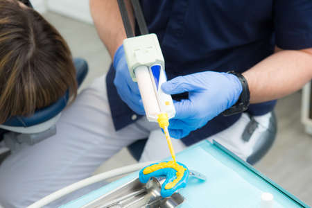 dental impressions, dental prosthetics, a dentist orthopedist holds a model of jaws in his hands and applies polymer from a special syringeの写真素材