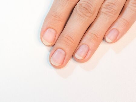 Completed manicure, prepared nails for applying varnish.の写真素材