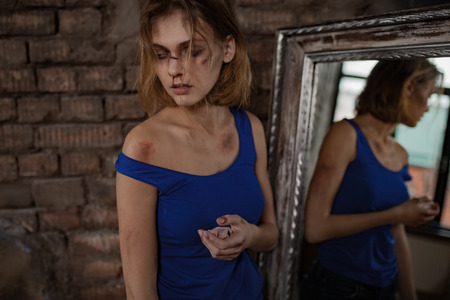 Beaten sad woman victim of domestic violence and abuse stands near mirror with bruises and wounds on her bloody face and body. Ð¡oncept of domestic violence, sexual violence and cruelty.の写真素材