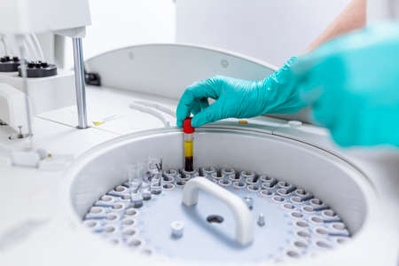 hands of female researcher loading samples in centrifuge in laboratoryの写真素材