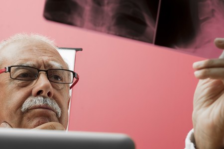 Senior doctor examining x-rayの写真素材