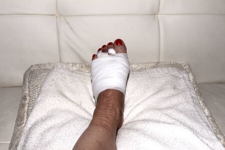 Foot after Mortons neuroma surgeryの写真素材