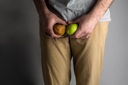 A man in beige jeans at the level of the genitals , holding a ripe and rotten apple. Disease for men. The concept of protection of sexually transmitted infections. Testicular cancer.の写真素材