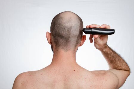 The concept of baldness and alopecia. A man holds a hair clipper and shaves the hair at the temples. The view from the back. Copy space.の写真素材