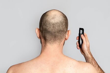 Male alopecia. A man with a receding hairline is holding an electric razor. Rear view. Shoulder-length view. Gray background. Copy space.の写真素材