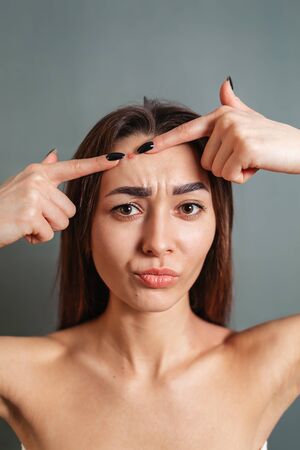 Cosmetology, Dermatology and acne. A young Caucasian brunette squeezes out a pimple on her forehead. Gray background. Copy space.の写真素材