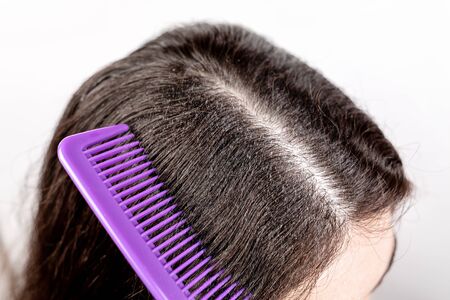 The woman is a brunette, parted her hair with a comb and shows dandruff. Close up. The view from the top. White background. The concept of dandruff and pediculosis.の写真素材
