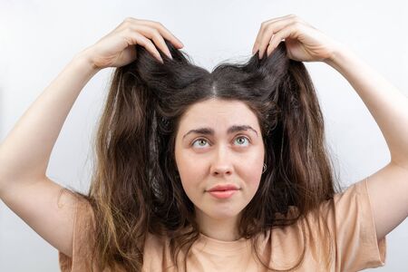 Dandruff, pediculosis and seborrhea. Portrait of a young Caucasian woman, a brunette, who lifts her hair with her hand, looking up. White background.の写真素材
