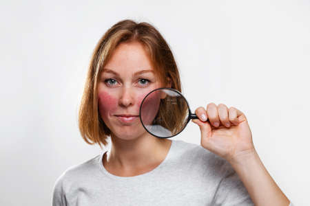 Portrait of a young woman showing redness on her cheeks, through a magnifying glass. White...