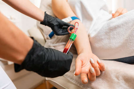 Cosmetologist makes blood sampling from the client's hand for the plasmolifting procedure. Professional rejuvenation procedure in salon. Close up.の写真素材