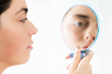Plastic surgery of the nose. Close up face of a young Caucasian woman looking at her humpback nose...