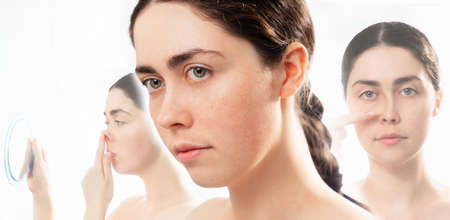 Aesthetic cosmetology. Three faces of young caucasian woman comparing results before and after plastic nose surgery. Isolated on white background. Concept of rhinoplasty.の写真素材