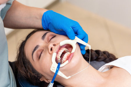 Close-up top view of young Caucasian woman lying at reception in dental office. Dentist puts retractor on woman. Concept of dentistry and orthodontics.の写真素材