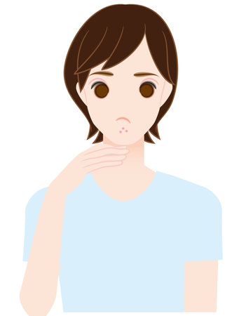 Acne, chin, menの写真素材
