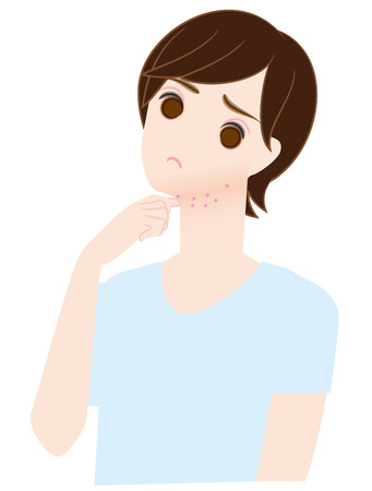 Acne, neck, jaw, manの写真素材