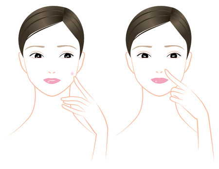 Stain, eruption, pore of the wings of the nose, middle age womanの写真素材