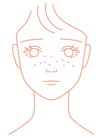 Freckles  Women  Faceの写真素材