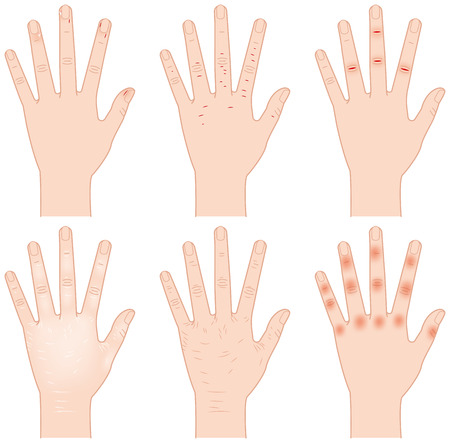 Rough handのイラスト素材