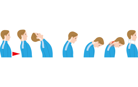 Movement of the neck due to impact from behind. Whiplash injury.のイラスト素材