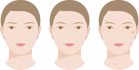 Illustration of a beauty image of a woman's face with spots and wrinklesのイラスト素材