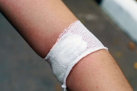 Arm rewound with a bandage after blood sampling.