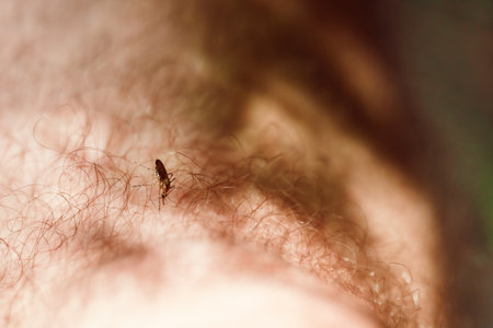 mosquito feasts on blood amidst leg hair, a close-up of nature's tiny predator