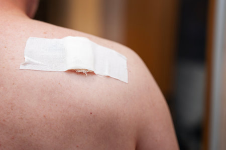 Human shoulder injury treated with bandage and medical tape, showcasing wound care and first aid...
