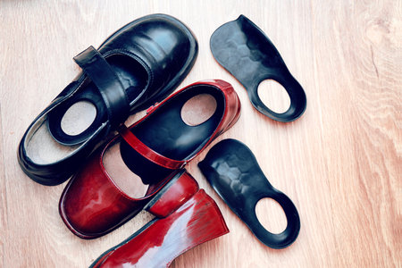 Orthopedic semi-insoles placed on home floor beside children's shoes for correcting foot joint...