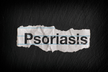 Torn piece of paper with the word Psoriasis. Close up.の写真素材