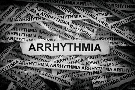 Strips of newspaper with the words Arrhythmia typed on them. Black and white. Close up.の写真素材