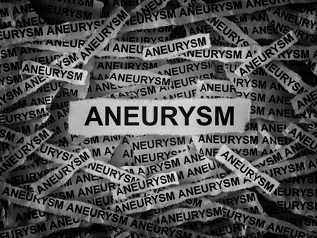 Strips of newspaper with the words Aneurysm typed on them. Black and white. Close up.の写真素材