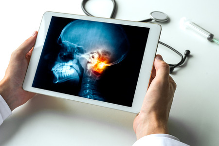 Doctor watching a x-ray of pain on a neck of a skull on digital tablet.
