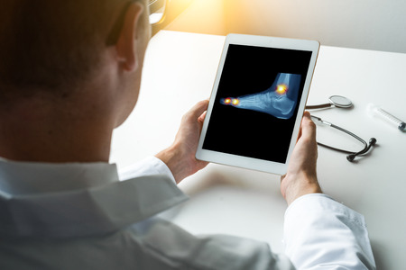 Doctor holding a digital tablet with x-ray of a pain in the ankle and toesの写真素材