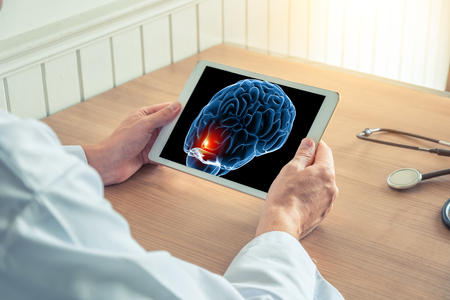 Doctor holding a digital tablet with x-ray of brain with pain on the front. Headache migraine conceptの写真素材