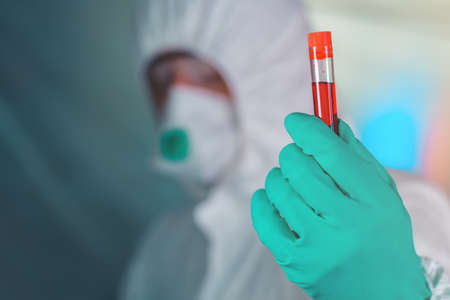 Epidemiologist with blood sample in test tube, selective focus