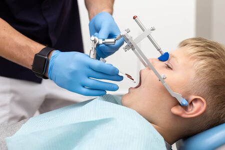 Little boy keep his mouth wide open while his dentist setting up orthodontic archの写真素材