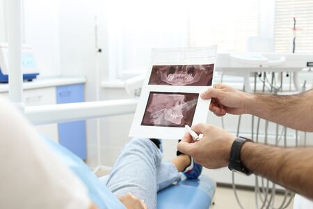 Dentist explains results of x-ray to his patient. Selective focusの写真素材