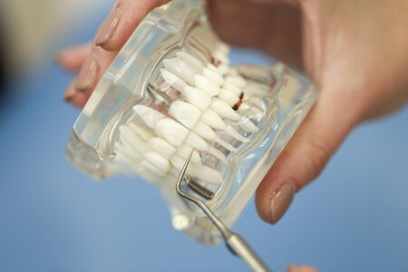 Closeup photo of female doctor with model of jaw in handsの写真素材