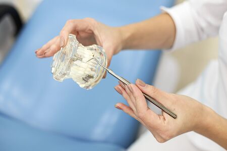 Closeup photo of female doctor with model of jaw in handsの写真素材