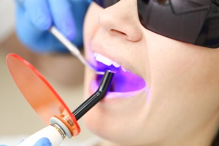 Blond woman wearig black glasses being examinated by stomatologist with UV. Selective focus.の写真素材