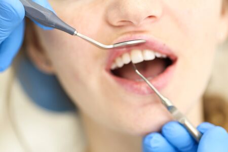 Closeup of face of female who undergo detntist checkup.の写真素材
