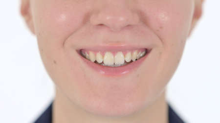 Close up of Smiling Mouth of Woman Looking at Camera